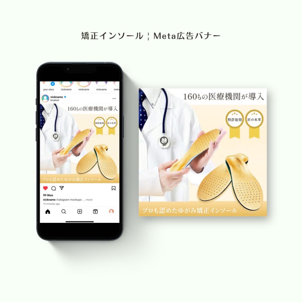 alt=矯正インソールバナー